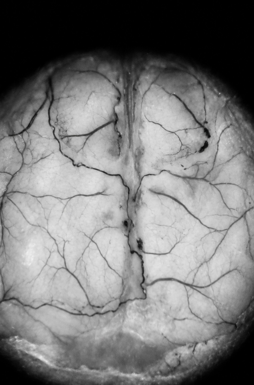 Grayscale dorsal cortical surface showing branching blood vessels across both hemispheres